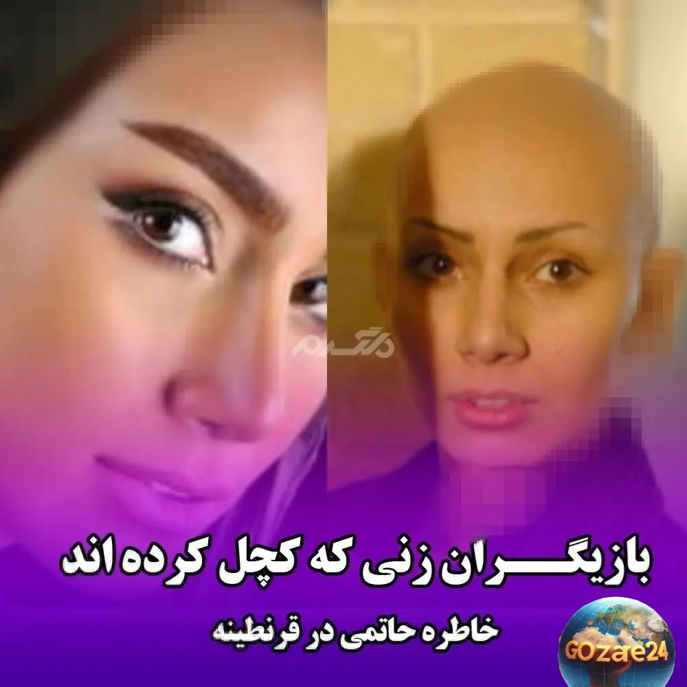 بازیگر زن