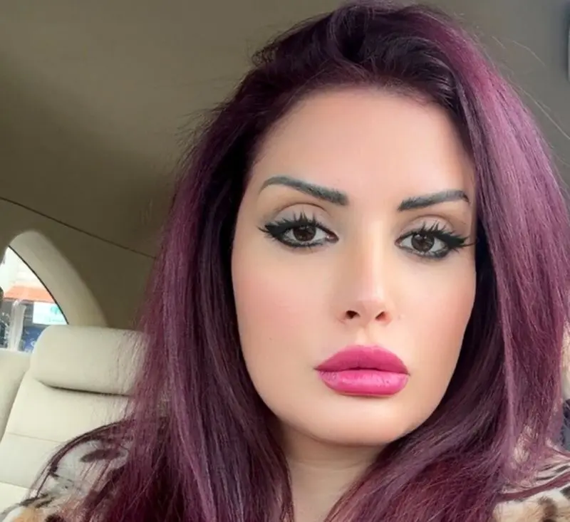 آن-ماری سلامه