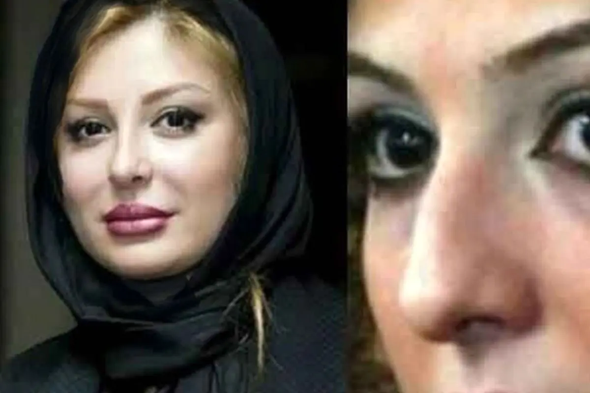 تصاویر قبل و بعد عمل زیبایی ستارههای ایرانی: تغییرات چشمگیر بازیگران زن و مرد در دنیای هنر