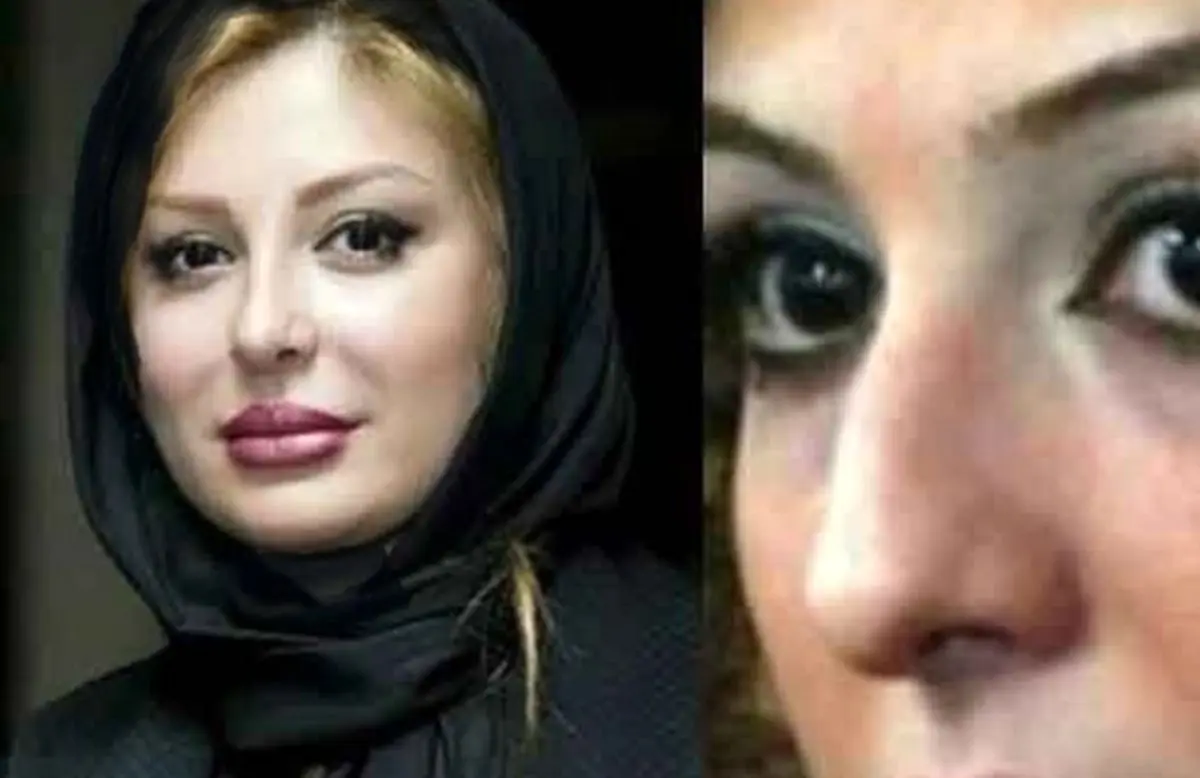 تصاویر قبل و بعد عمل زیبایی ستاره‌های ایرانی: تغییرات چشم‌گیر بازیگران زن و مرد در دنیای هنر