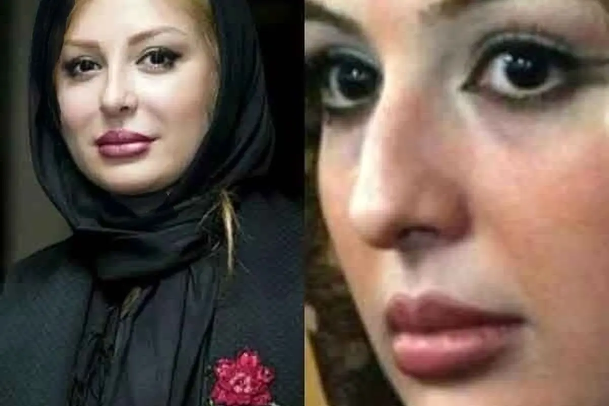 تصاویر قبل و بعد عمل زیبایی بازیگران زن ایرانی: تغییرات حیرتانگیز ستارهها از شیلا خداداد تا نگار فروزنده