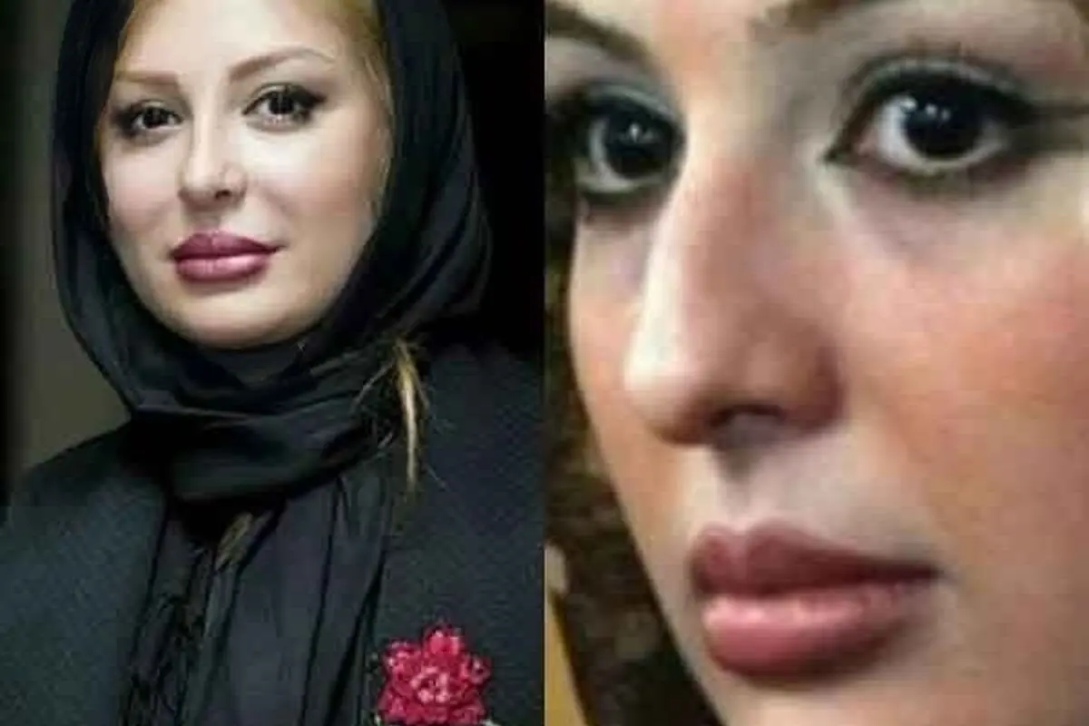 تصاویر قبل و بعد عمل زیبایی بازیگران زن ایرانی: تغییرات حیرت‌انگیز ستاره‌ها از شیلا خداداد تا نگار فروزنده