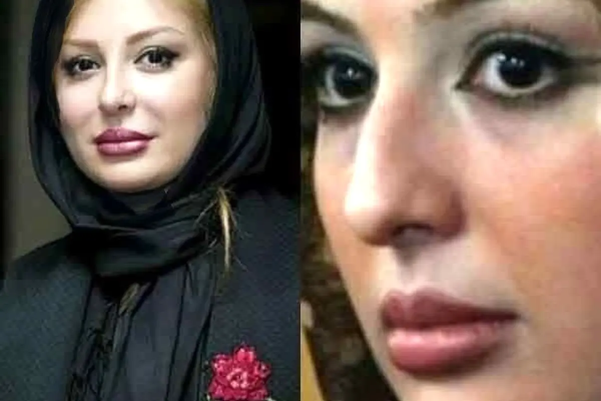 تصاویر قبل و بعد عمل زیبایی بازیگران زن ایرانی: تغییرات حیرت‌انگیز ستاره‌ها از شیلا خداداد تا نگار فروزنده
