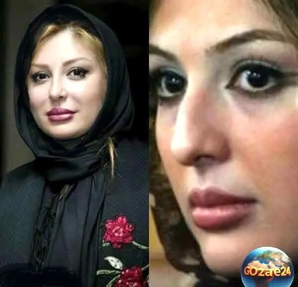 تصاویر قبل و بعد عمل زیبایی بازیگران زن ایرانی: تغییرات حیرت‌انگیز ستاره‌ها از شیلا خداداد تا نگار فروزنده