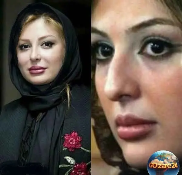 تصاویر قبل و بعد عمل زیبایی بازیگران زن ایرانی: تغییرات حیرت‌انگیز ستاره‌ها از شیلا خداداد تا نگار فروزنده