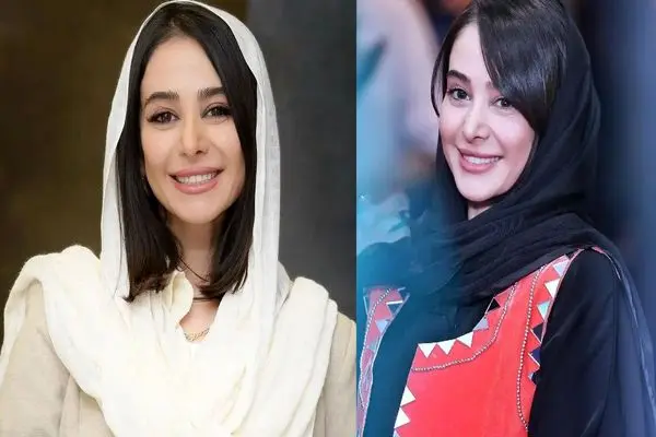 تغییر چهره الناز حبیبی: تصاویر قبل و بعد از جراحی‌های زیبایی با تفاوت چشم‌نواز