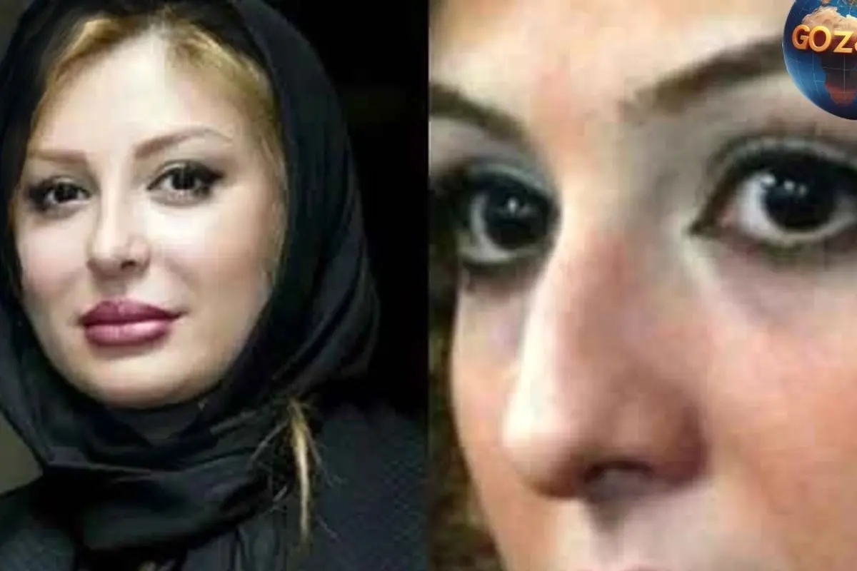 تصاویر قبل و بعد عمل زیبایی بازیگران زن ایرانی | شیلا خداداد، سحر دولتشاهی و دیگر ستاره‌ها