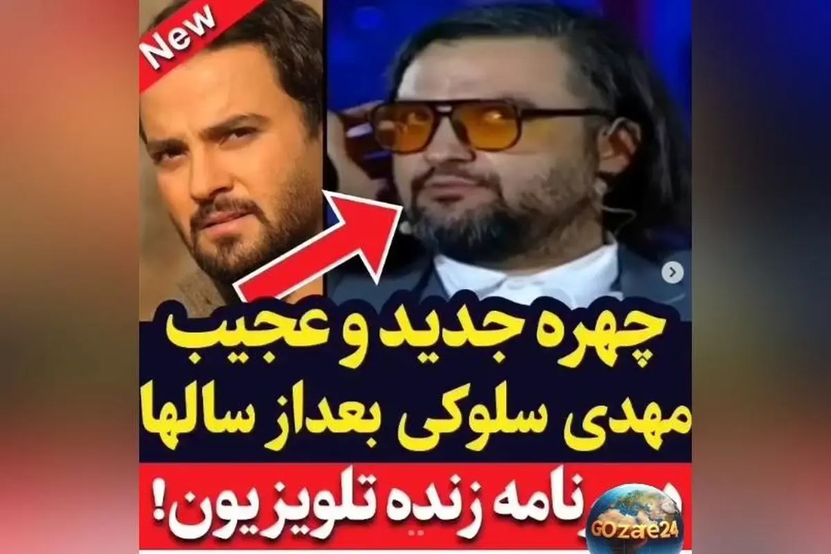 تغییر عجیب و باورنکردنی چهره مهدی سلوکی در سریال ستایش + ویدیوی تغییرات چهره و حرکات خاص