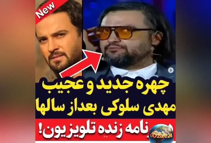 تغییر عجیب و باورنکردنی چهره مهدی سلوکی در سریال ستایش + ویدیوی تغییرات چهره و حرکات خاص