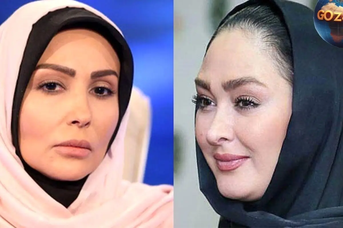 تغییرات چشمگیر چهره پرستو صالحی و الهام حمیدی؛ قبل و بعد از تحول تصویری جذاب را ببینید