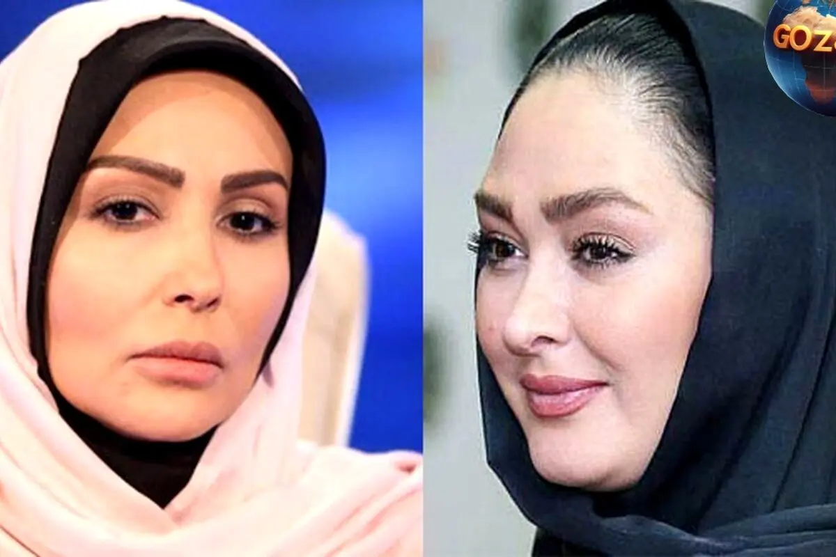 تغییرات چشمگیر چهره پرستو صالحی و الهام حمیدی؛ قبل و بعد از تحول تصویری جذاب را ببینید
