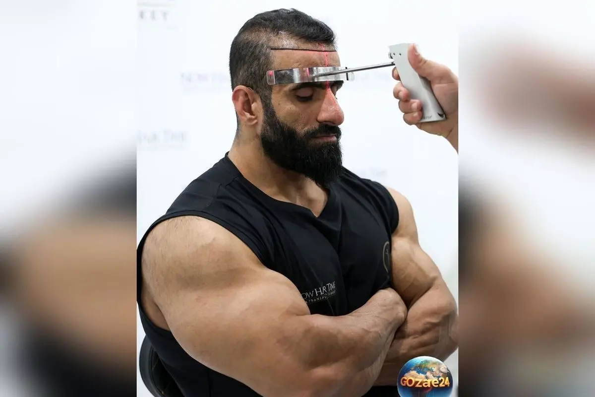 هادی چوپان، قهرمان مستر المپیا، در مرکز زیبایی جهانی برای جذاب‌تر شدن + تصاویر