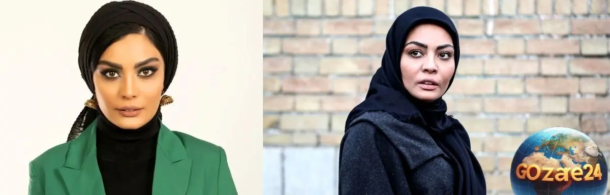 تحول شگفت‌انگیز چهره بازیگر جوان صحرا اسداللهی قبل و بعد عمل زیبایی + تصاویر