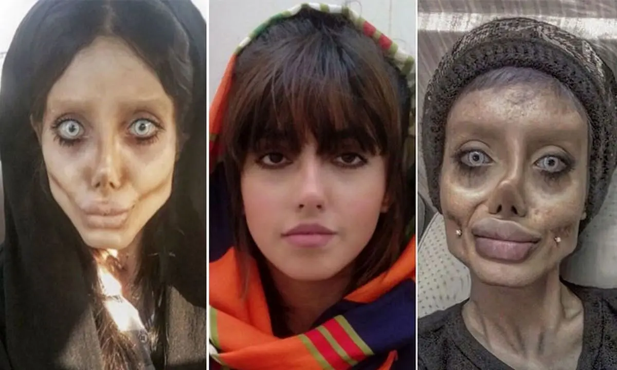 بیوگرافی و زندگی جنجالی سحر تبر، عروس مرده اینستاگرام با عکس‌های قبل و بعد از عمل + جزئیات بازداشت