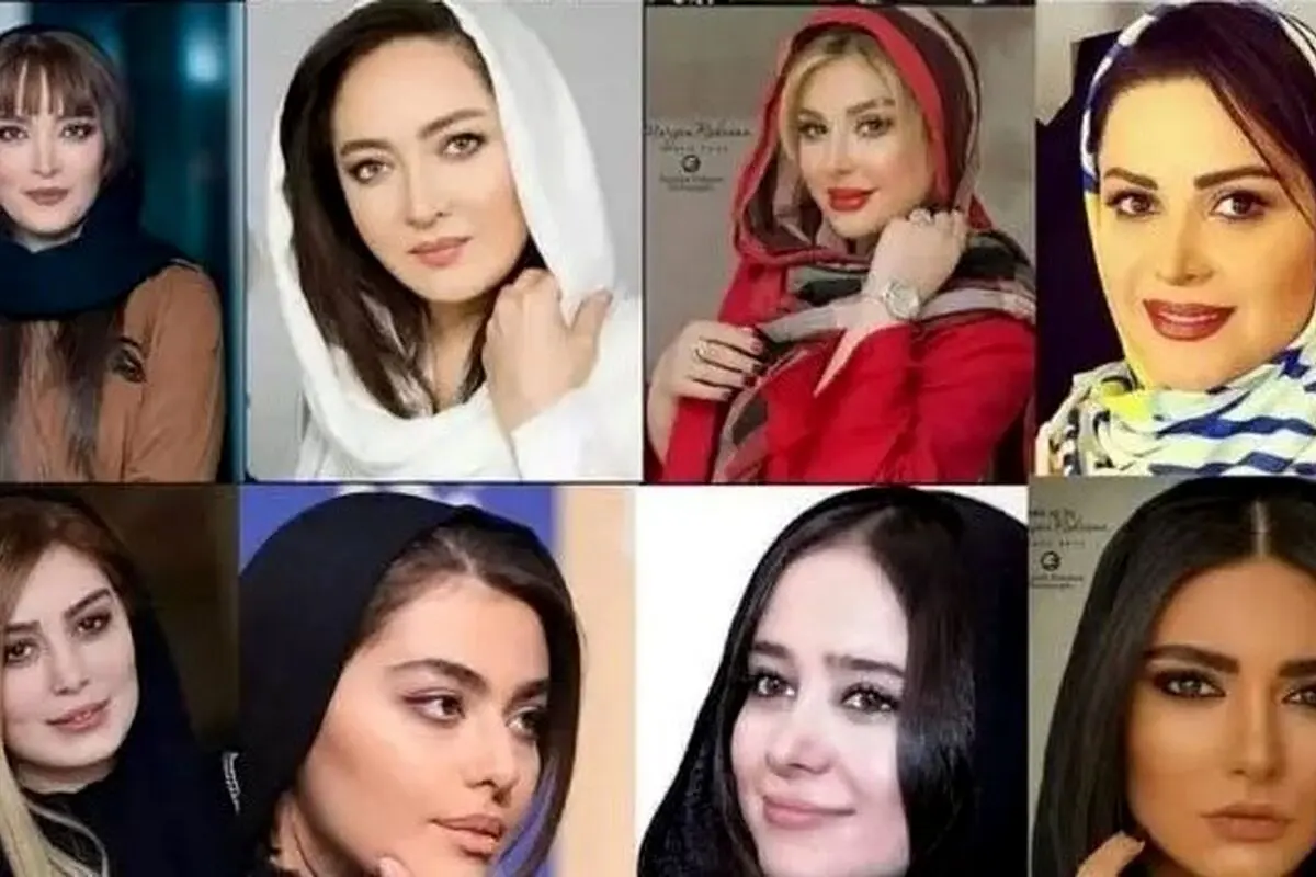 تغییرات شگفت‌انگیز چهره بازیگران زن ایرانی قبل و بعد از عمل‌های زیبایی؛ تصاویر و تحلیل‌های جذاب