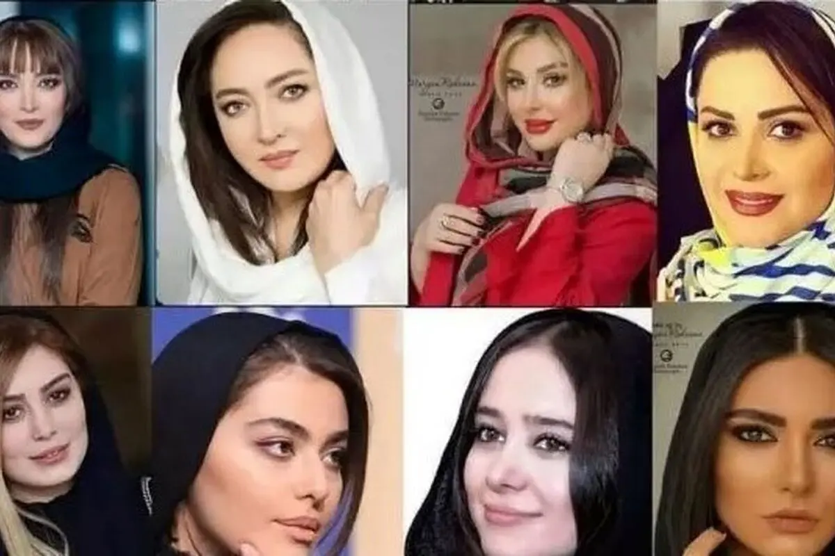 تغییرات شگفت‌انگیز چهره بازیگران زن ایرانی قبل و بعد از عمل‌های زیبایی؛ تصاویر و تحلیل‌های جذاب