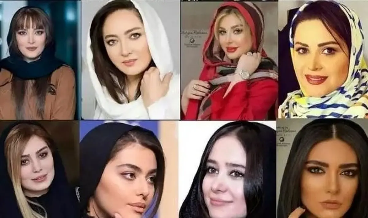 تغییرات شگفت‌انگیز چهره بازیگران زن ایرانی قبل و بعد از عمل‌های زیبایی؛ تصاویر و تحلیل‌های جذاب