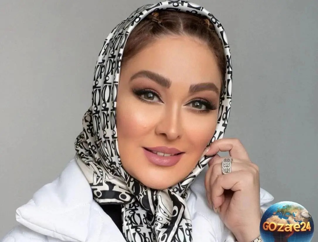 تغییر حیرت‌انگیز چهره الهام حمیدی؛ قبل و بعدی که شما را شوکه می‌کند + عکس