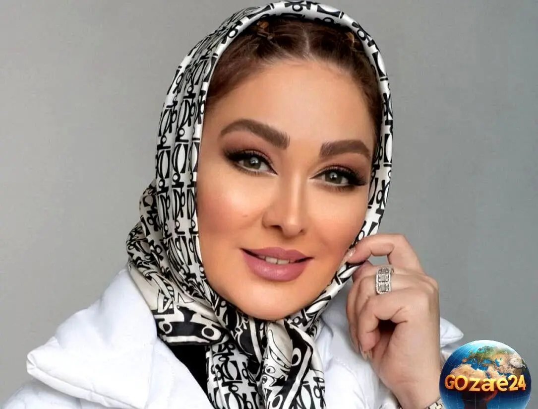 تغییر حیرت‌انگیز چهره الهام حمیدی؛ قبل و بعدی که شما را شوکه می‌کند + عکس