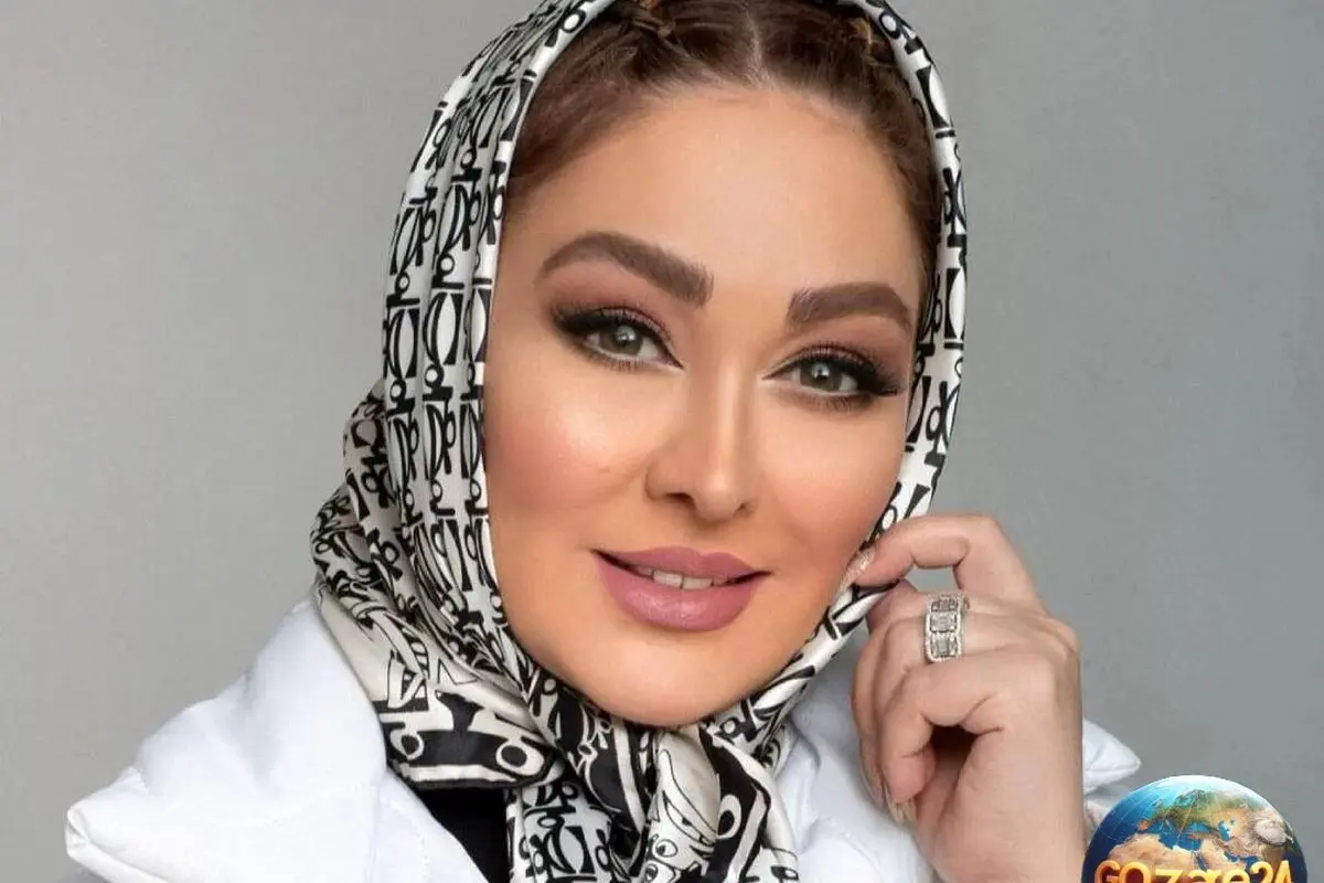 تغییر حیرتانگیز چهره الهام حمیدی؛ قبل و بعدی که شما را شوکه میکند + عکس