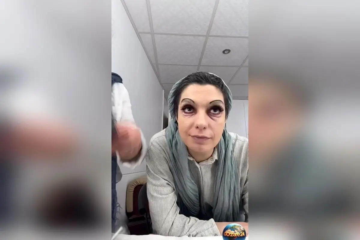 گریم متفاوت و عجیب الیکا عبدالرزاقی؛ تغییر چهره خانم بازیگر و شگفتی در ظاهر او