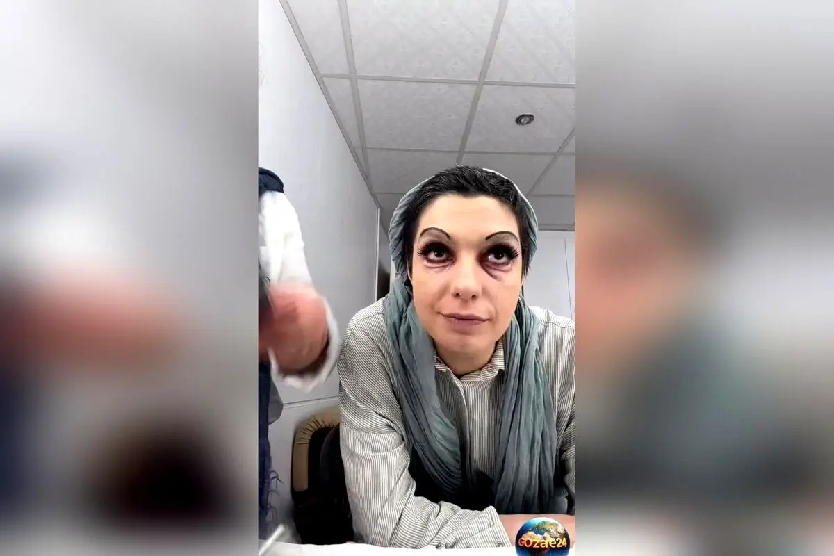 گریم متفاوت و عجیب الیکا عبدالرزاقی؛ تغییر چهره خانم بازیگر و شگفتی در ظاهر او