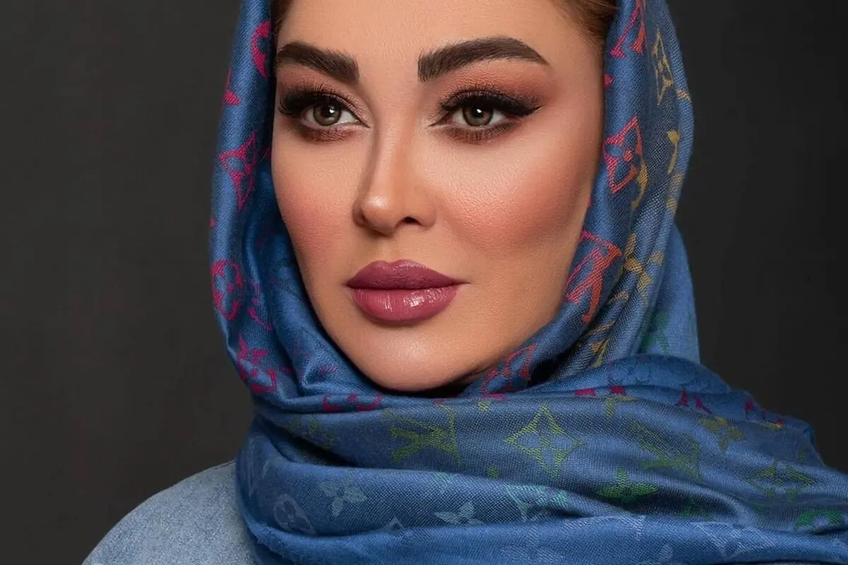 تصویر لورفته و زخمی الهام حمیدی در شبکه‌های اجتماعی؛ حقیقت یا حاشیه جدید؟