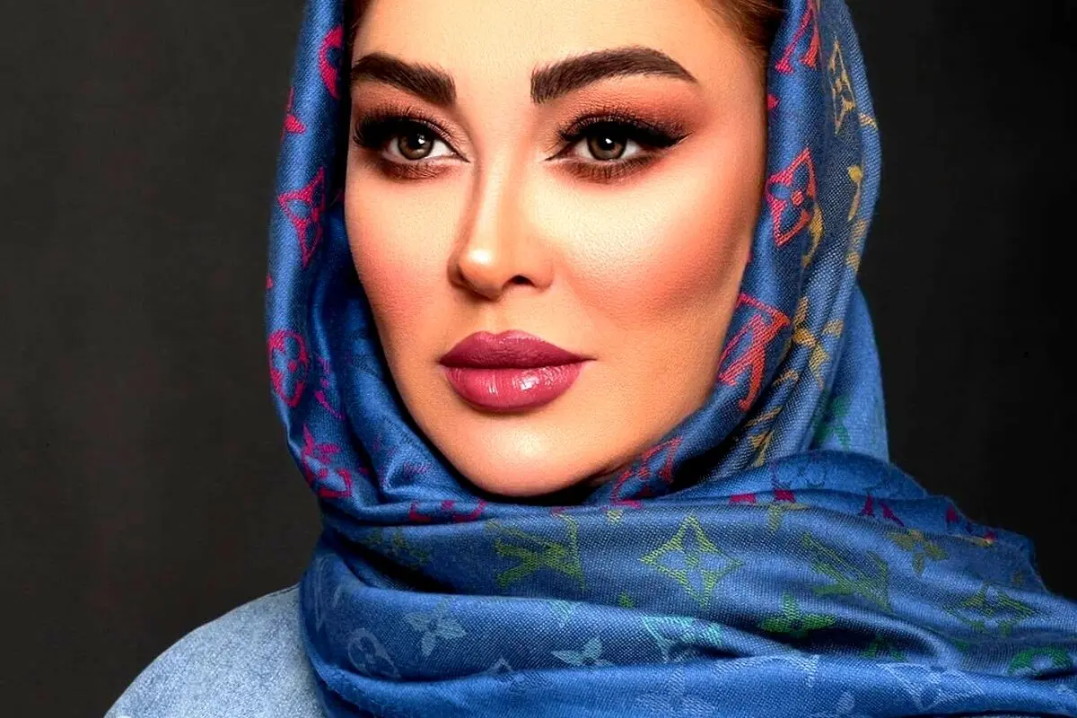 تصویر لورفته و زخمی الهام حمیدی در شبکه‌های اجتماعی؛ حقیقت یا حاشیه جدید؟