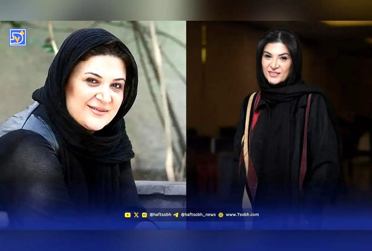 تغییرات چهره ریما رامین فر بازیگر نقش هما در 10 سال گذشته | سفر در زمان و تصاویر کمتر دیده شده