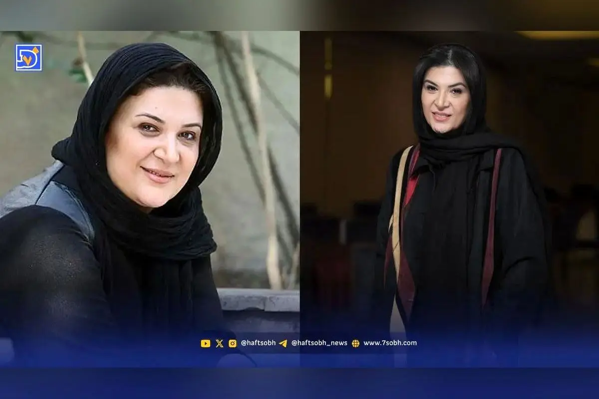 تغییرات چهره ریما رامین فر بازیگر نقش هما در 10 سال گذشته | سفر در زمان و تصاویر کمتر دیده شده