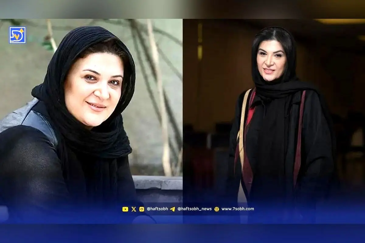 تغییرات چهره ریما رامین فر بازیگر نقش هما در 10 سال گذشته | سفر در زمان و تصاویر کمتر دیده شده