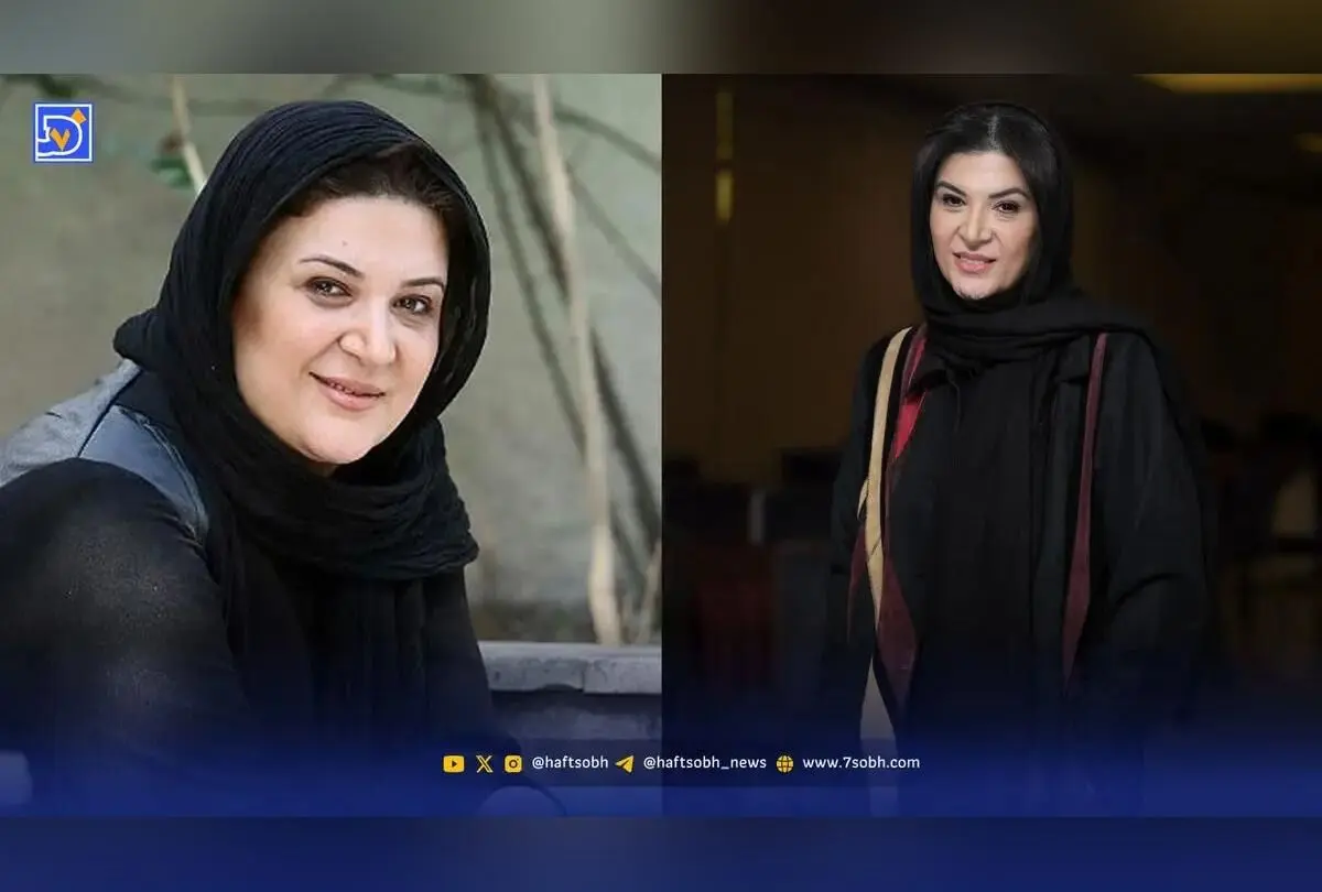 تغییرات چهره ریما رامین فر بازیگر نقش هما در 10 سال گذشته | سفر در زمان و تصاویر کمتر دیده شده