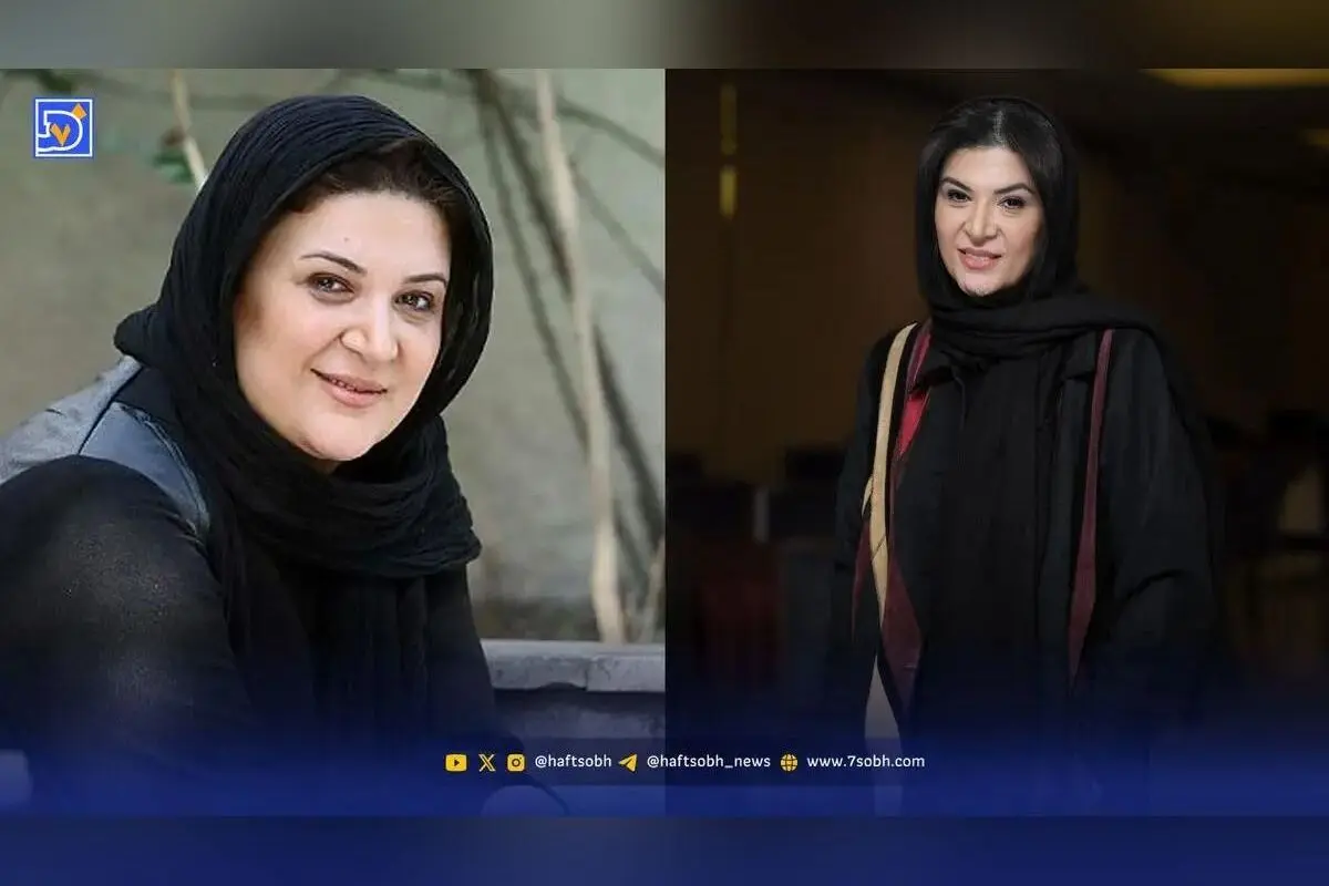 تغییرات چهره ریما رامین فر بازیگر نقش هما در 10 سال گذشته | سفر در زمان و تصاویر کمتر دیده شده