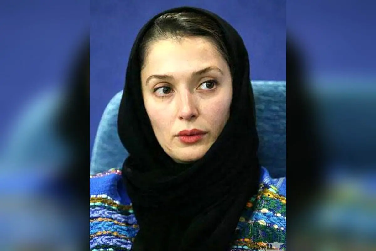 تصویر دلخراش آتنه فقیه نصیری پس از مقابله با بیماری ام‌اس و تغییرات چهره او