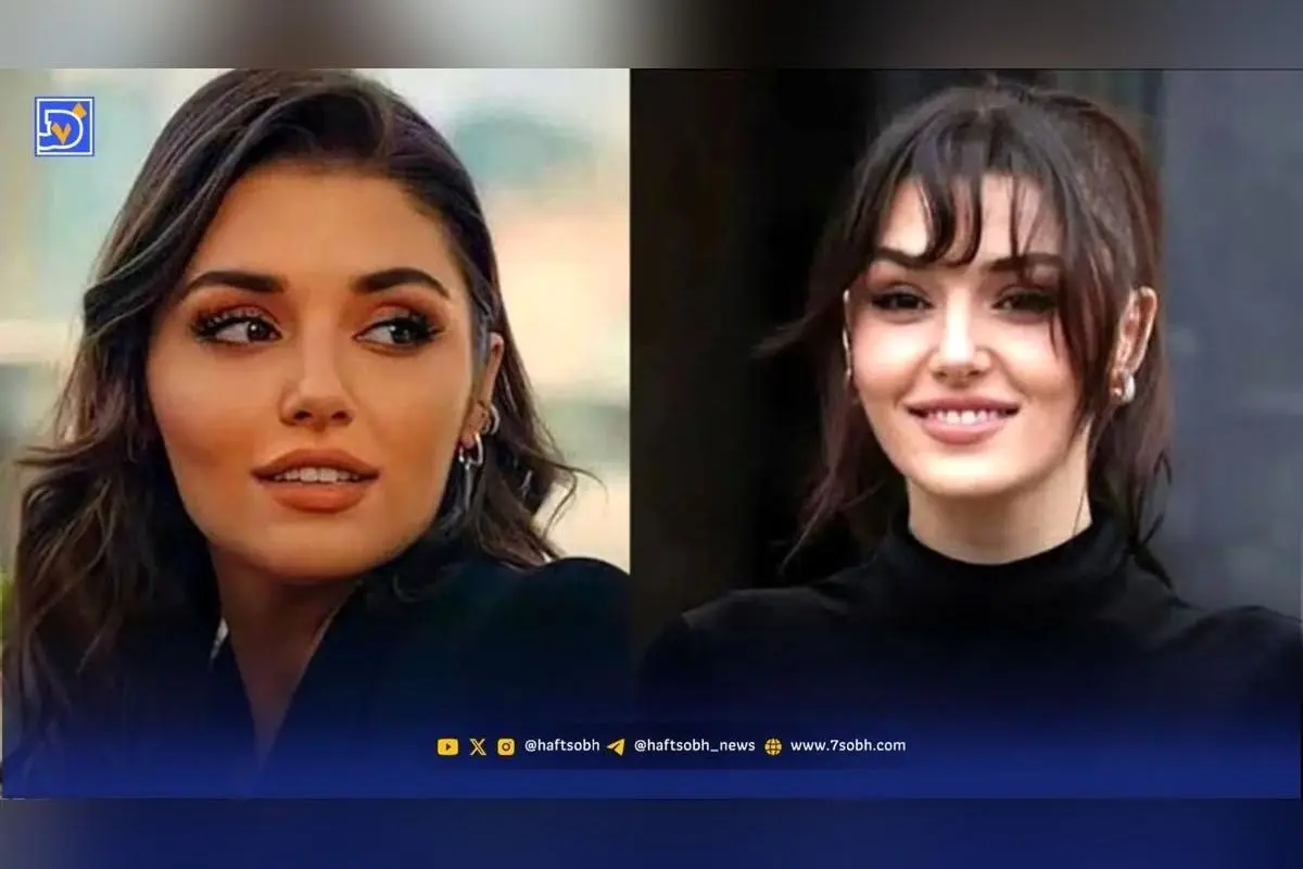 بیوگرافی هانده ارچل، ستاره زیبا و موفق ترکیه + تصاویر عروسی و رازهای شهرت