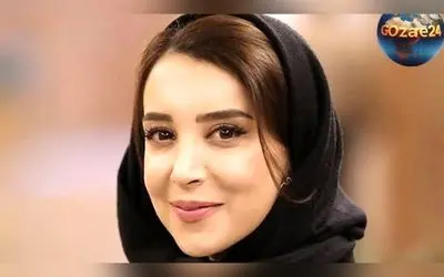 سحر جعفری جوزانی فاش کرد: تجربه تلخ فلج فک و عوارض جبران‌ناپذیر تزریق بوتاکس در دندان عقل