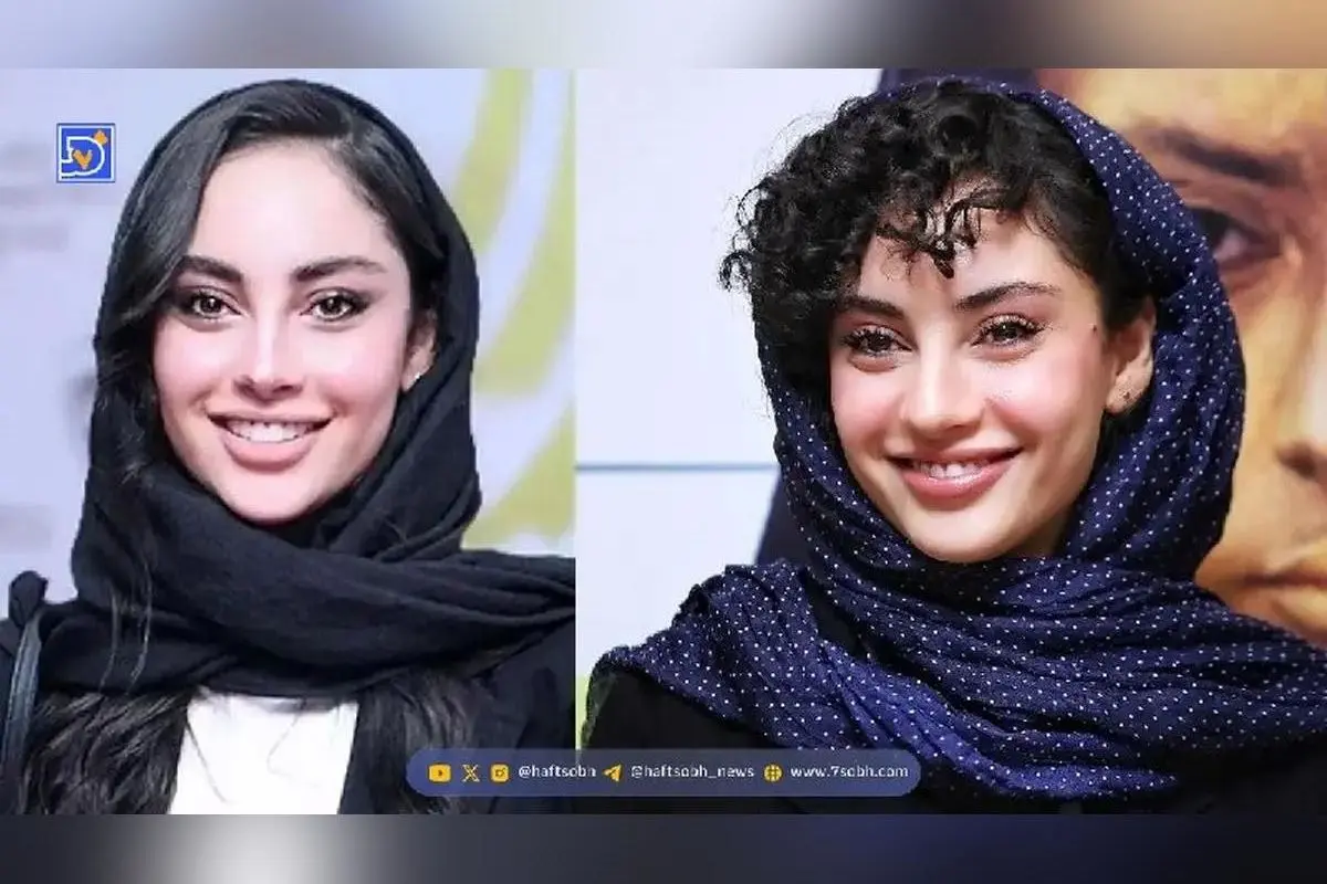 چهره بدون آرایش بهنوش بختیاری و ترلان پروانه: مقایسه زیبایی طبیعی بازیگران بامداد خمار