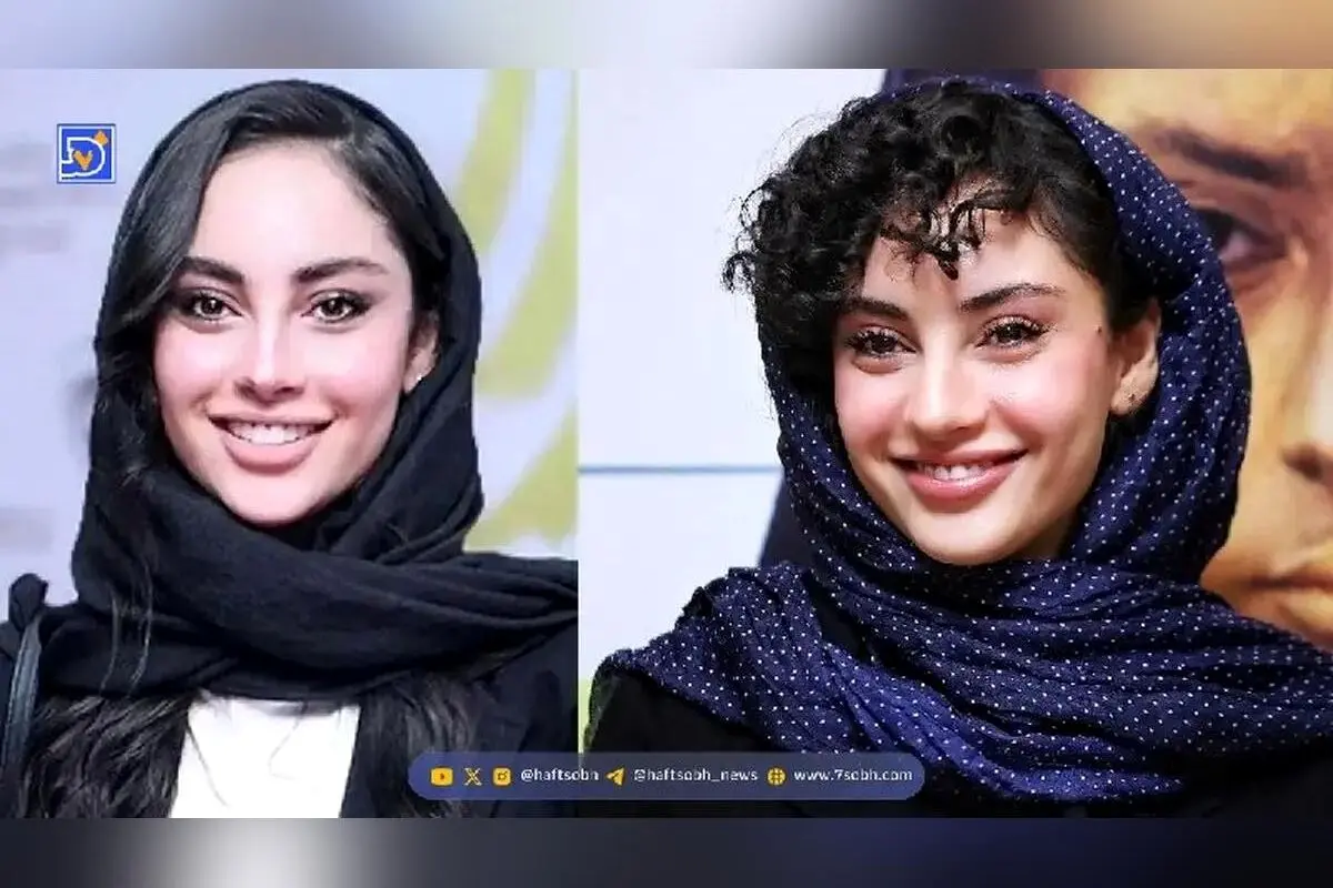 چهره بدون آرایش بهنوش بختیاری و ترلان پروانه: مقایسه زیبایی طبیعی بازیگران بامداد خمار