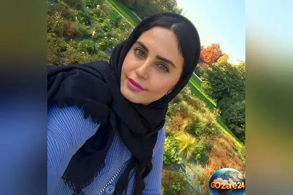 عکس الناز شاکردوست در نزدیک‌ترین حالت به چهره اسکار + سلفی جذاب و دیدنی