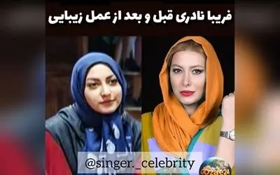فریبا نادری بازیگر سرشناس: چرا بعد از پخش فیلم تصمیم به عمل بینی گرفت؟ | جزئیات صحبتهای او در برنامه دورهمی