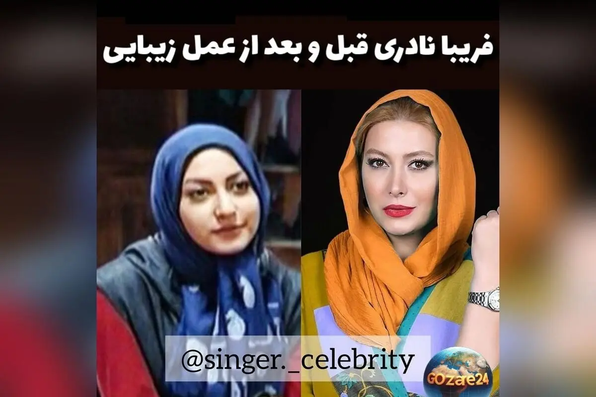 فریبا نادری بازیگر سرشناس: چرا بعد از پخش فیلم تصمیم به عمل بینی گرفت؟ | جزئیات صحبت‌های او در برنامه دورهمی