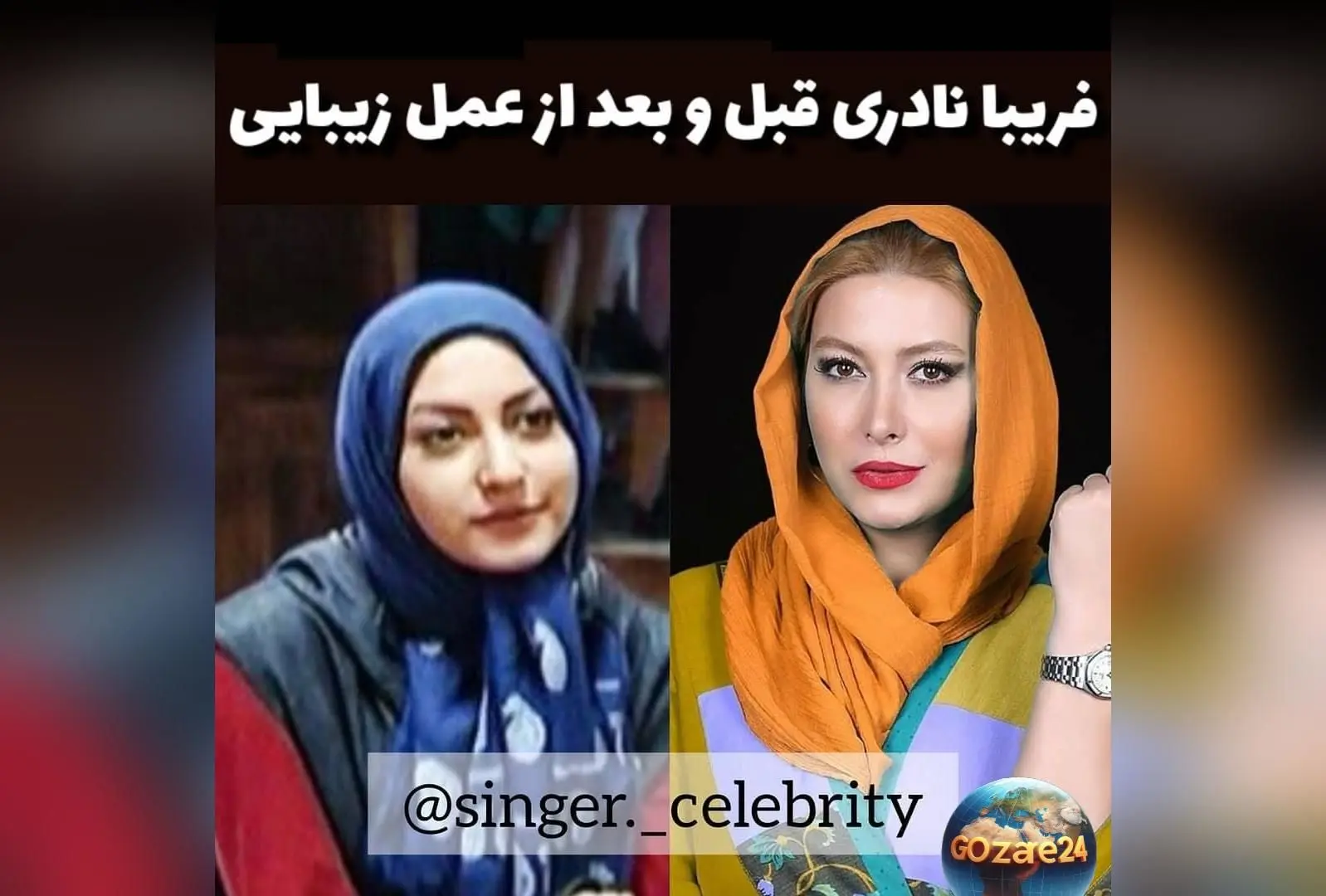فریبا نادری بازیگر سرشناس: چرا بعد از پخش فیلم تصمیم به عمل بینی گرفت؟ | جزئیات صحبت‌های او در برنامه دورهمی