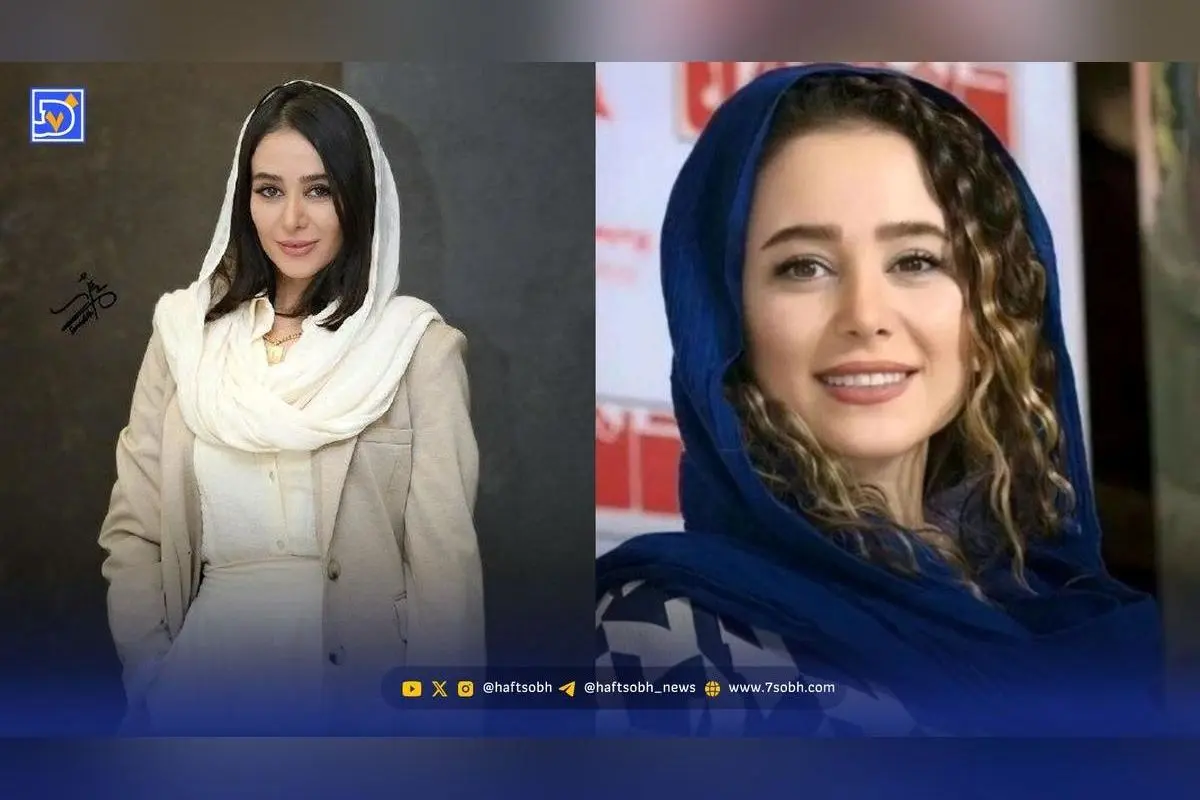 الناز حبیبی پس از کاشت مژده با تغییر چهره باورنکردنی؛ عکس جدید و جذاب بازیگر محبوب ایرانی