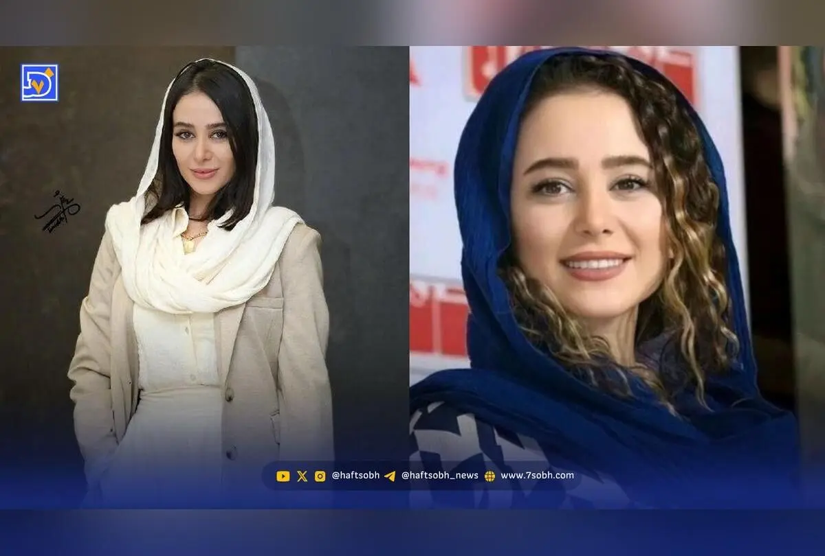 الناز حبیبی پس از کاشت مژده با تغییر چهره باورنکردنی؛ عکس جدید و جذاب بازیگر محبوب ایرانی