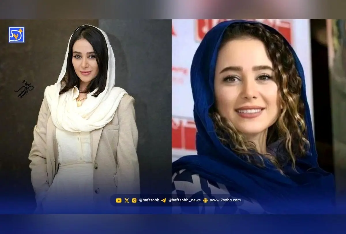 الناز حبیبی پس از کاشت مژده با تغییر چهره باورنکردنی؛ عکس جدید و جذاب بازیگر محبوب ایرانی