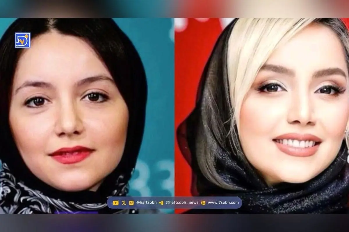 تحول طبیعی و هوشمندانه چهره نازنین بیاتی؛ رازهای زیبایی و جراحی‌های زیرپوستی ستاره محبوب ایرانی