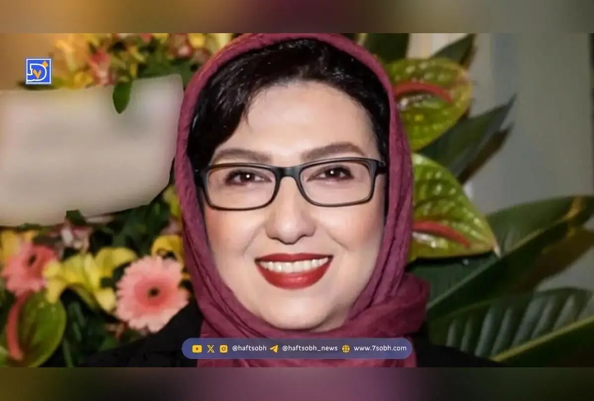 تصویر جدید معصومه کریمی در فضای مجازی؛ تغییر چهره بازیگر «زیر آسمان شهر» و واکنش کاربران