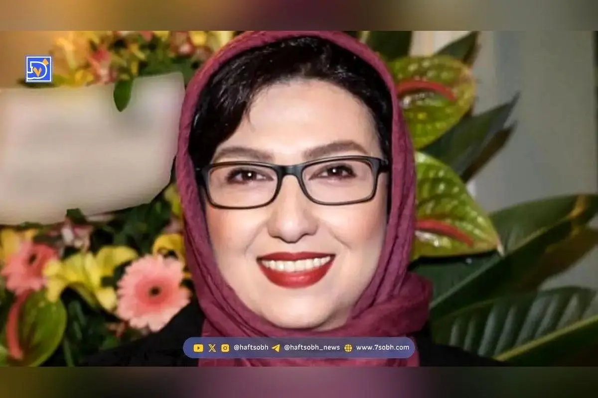 تصویر جدید معصومه کریمی در فضای مجازی؛ تغییر چهره بازیگر «زیر آسمان شهر» و واکنش کاربران