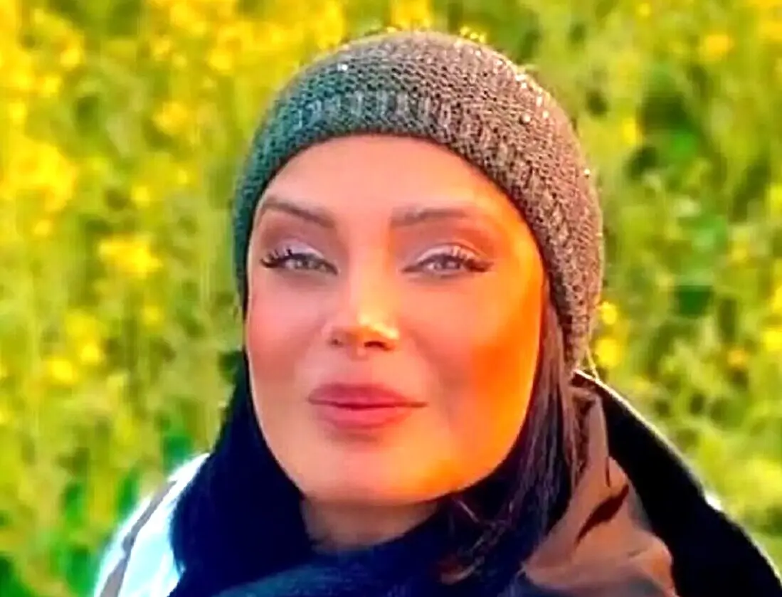 تغییر چشمگیر استایل صبا راد پس از چند ماه غیبت در فضای مجازی