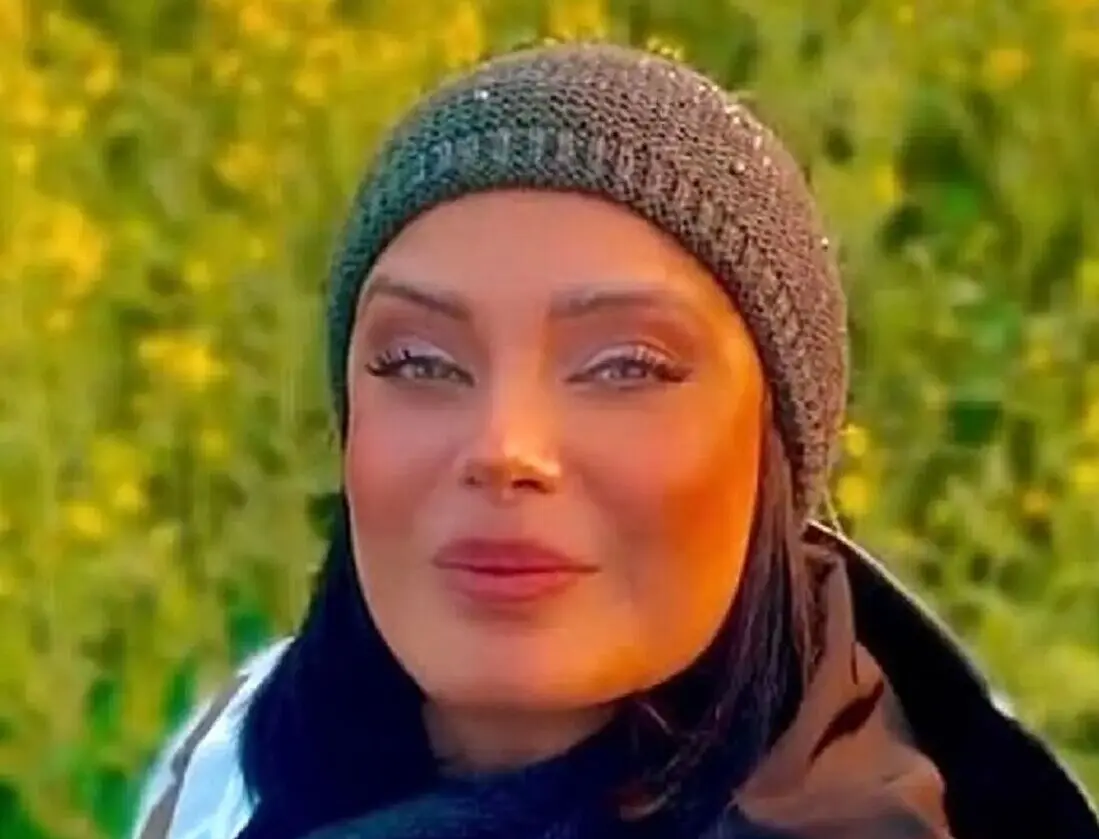 تغییر چشمگیر استایل صبا راد پس از چند ماه غیبت در فضای مجازی
